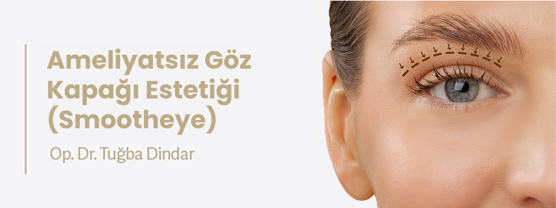 Ameliyatsız Göz Kapağı Estetiği (Smootheye)