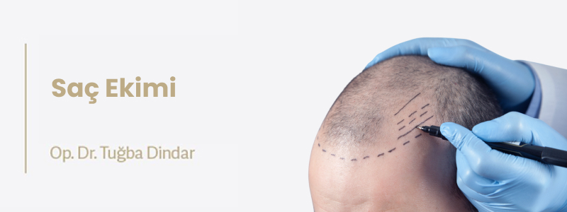 Saç Ekimi